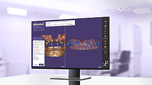 exoplan on desktop screen