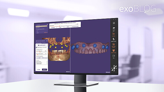 exoplan on desktop screen