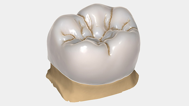 Anatomic crowns