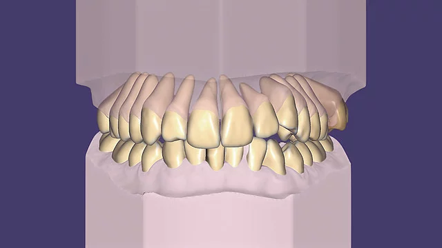 exocad Ortho