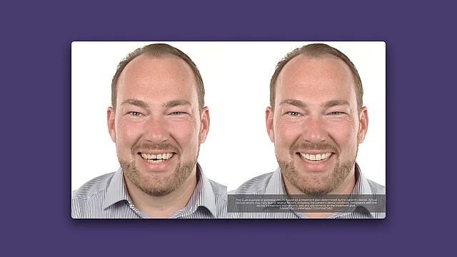 TruSmile® Video und TruSmile® Photo