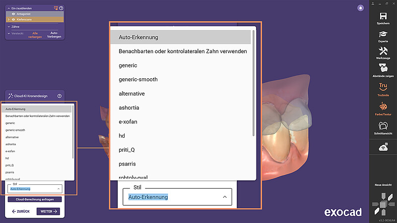 KI-Services - exocad