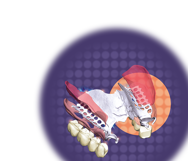 DentalCAD 3.2 Elefsina hero