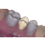Provisional Module