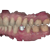 Implant Module