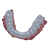 Bite Splint Module