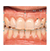 Smile Creator