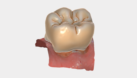 Anatomic crowns