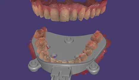 Jaw Motion Import