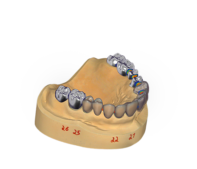 DentalCAD key visual