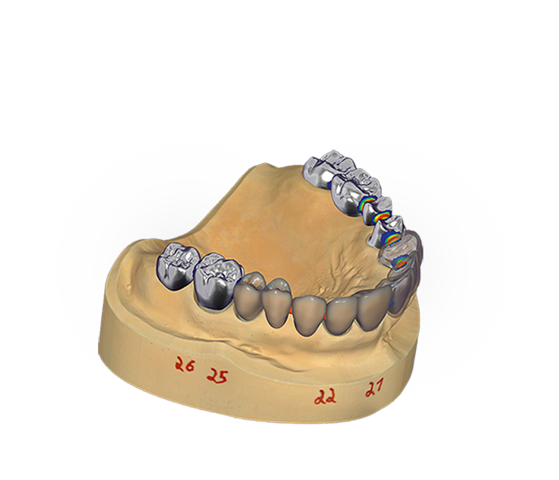 DentalCAD key visual