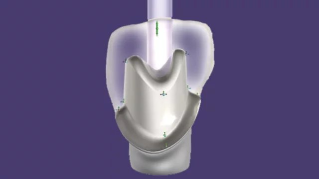 Custom abutments