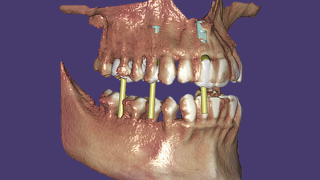 Visualization of voxel data from CT machines