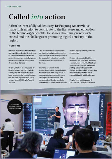 Thumbnail_exocad_Editorial_Dental Asia_Called into action