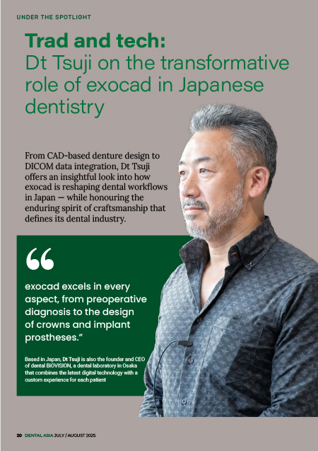 Thumbnail_exocad_Editorial_Dental Asia_Called into action