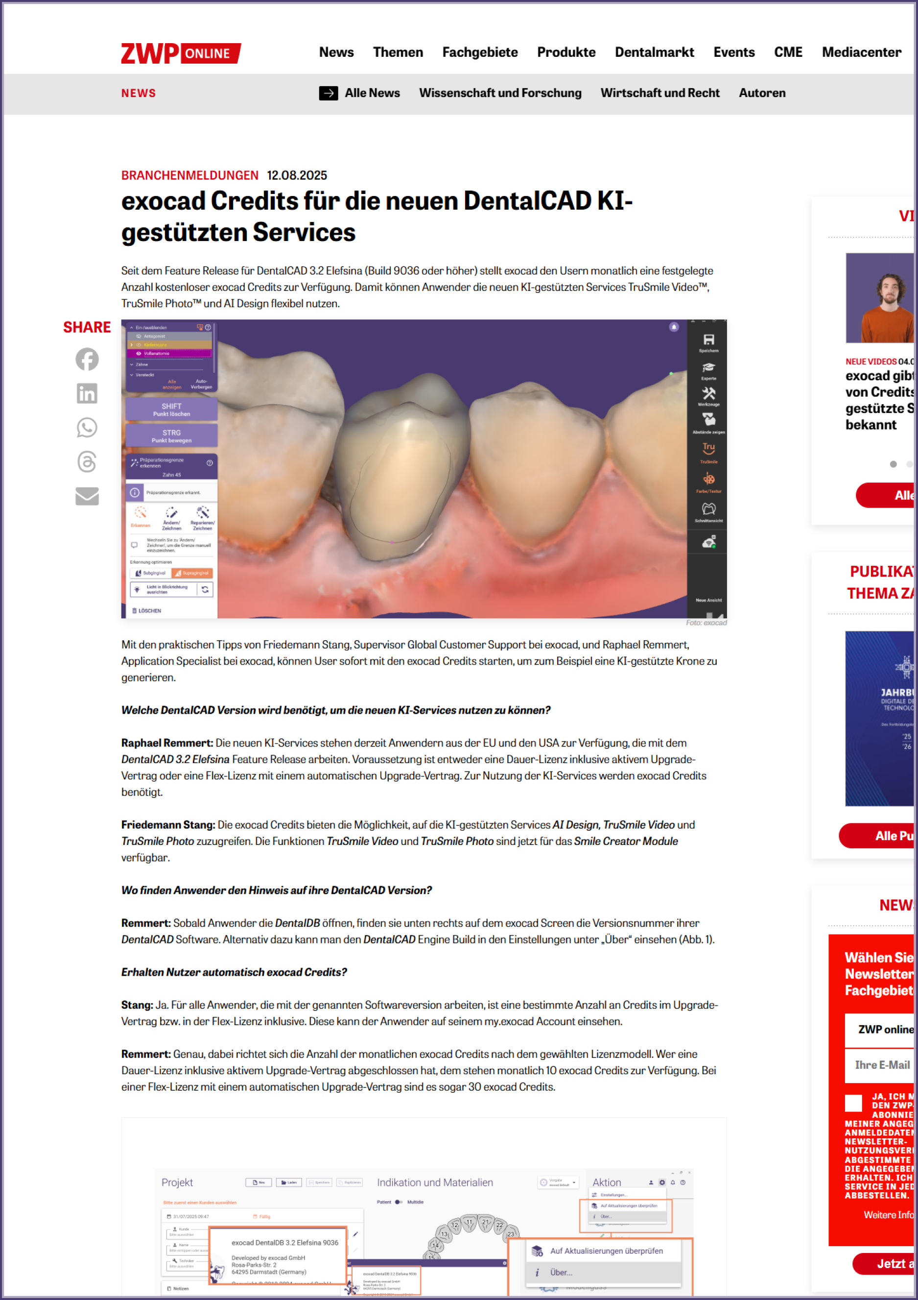 Thumbnail_exocad_Press Area_ZWP_Credits