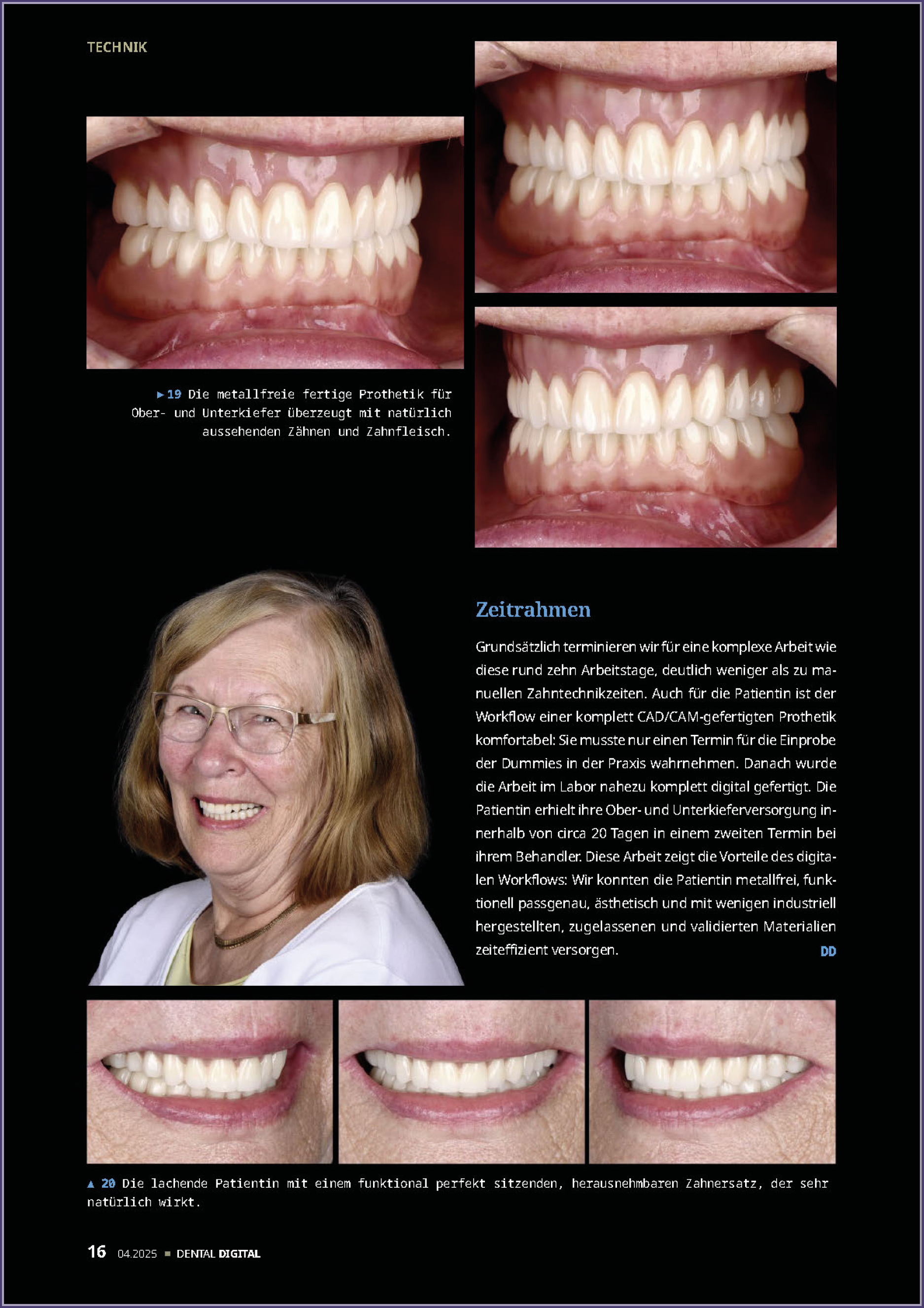 Thumb_exocad_Press_Room_Editotial_Thumb_dental labor_Wichnalek