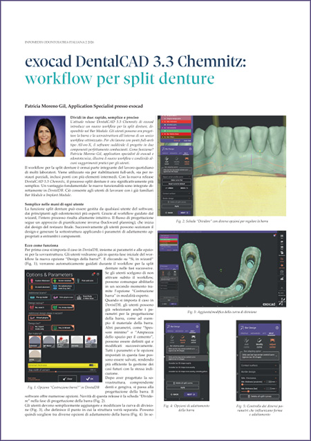 exocad_Press_Room_Editotial_Thumb_Infomedix_Patricia