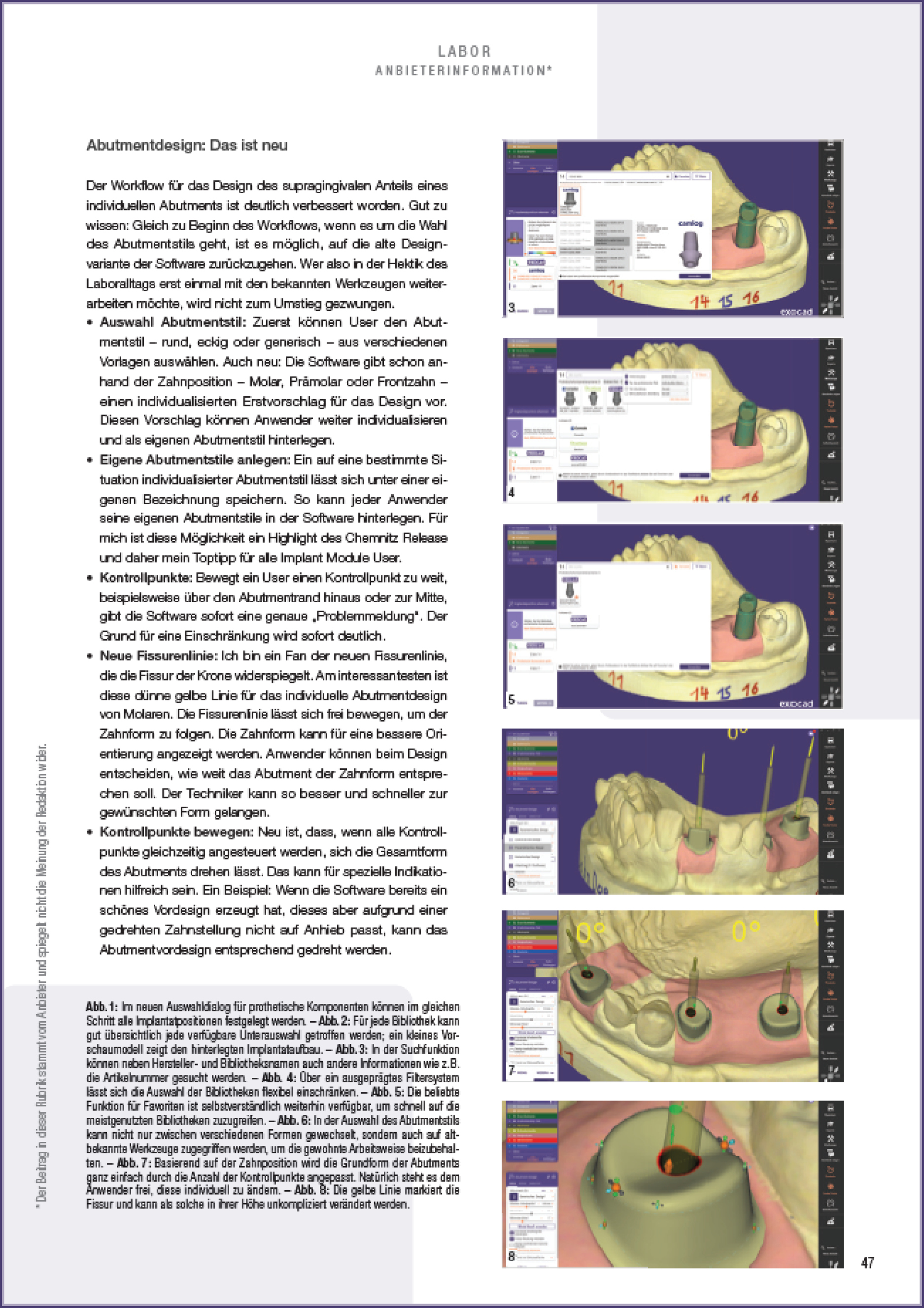 Thumbnail_exocad_Press Area_ZWL_Friedemann