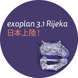 exocad_exoplan_rijeka_Jap